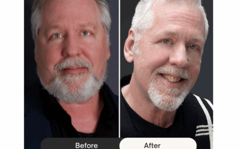 Andrew’s Life-Changing Weight Loss Journey at California Wellness Institute Post